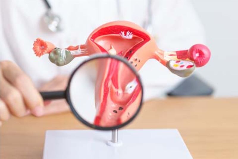 Close up of a model of a uterus 